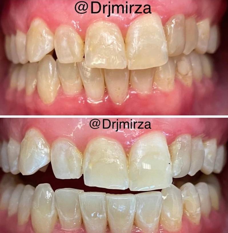 General Dental Services in Greensboro