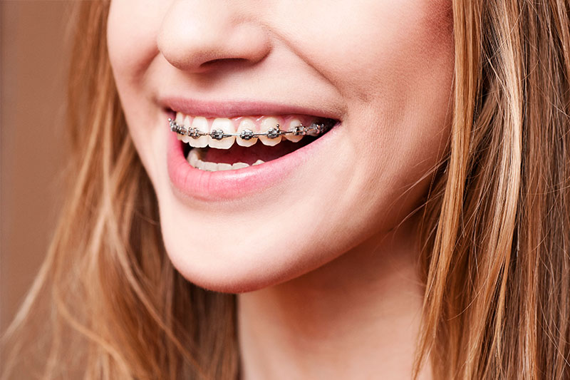 Orthodontics in Greensboro